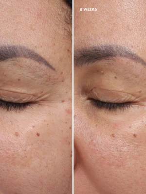 Total Eye® Firm & Repair Cream