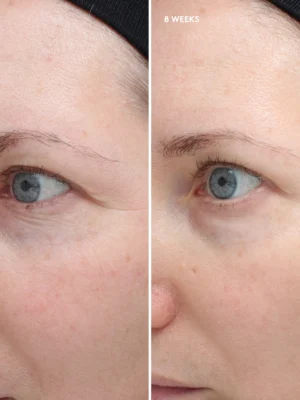 Total Eye® Firm & Repair Cream