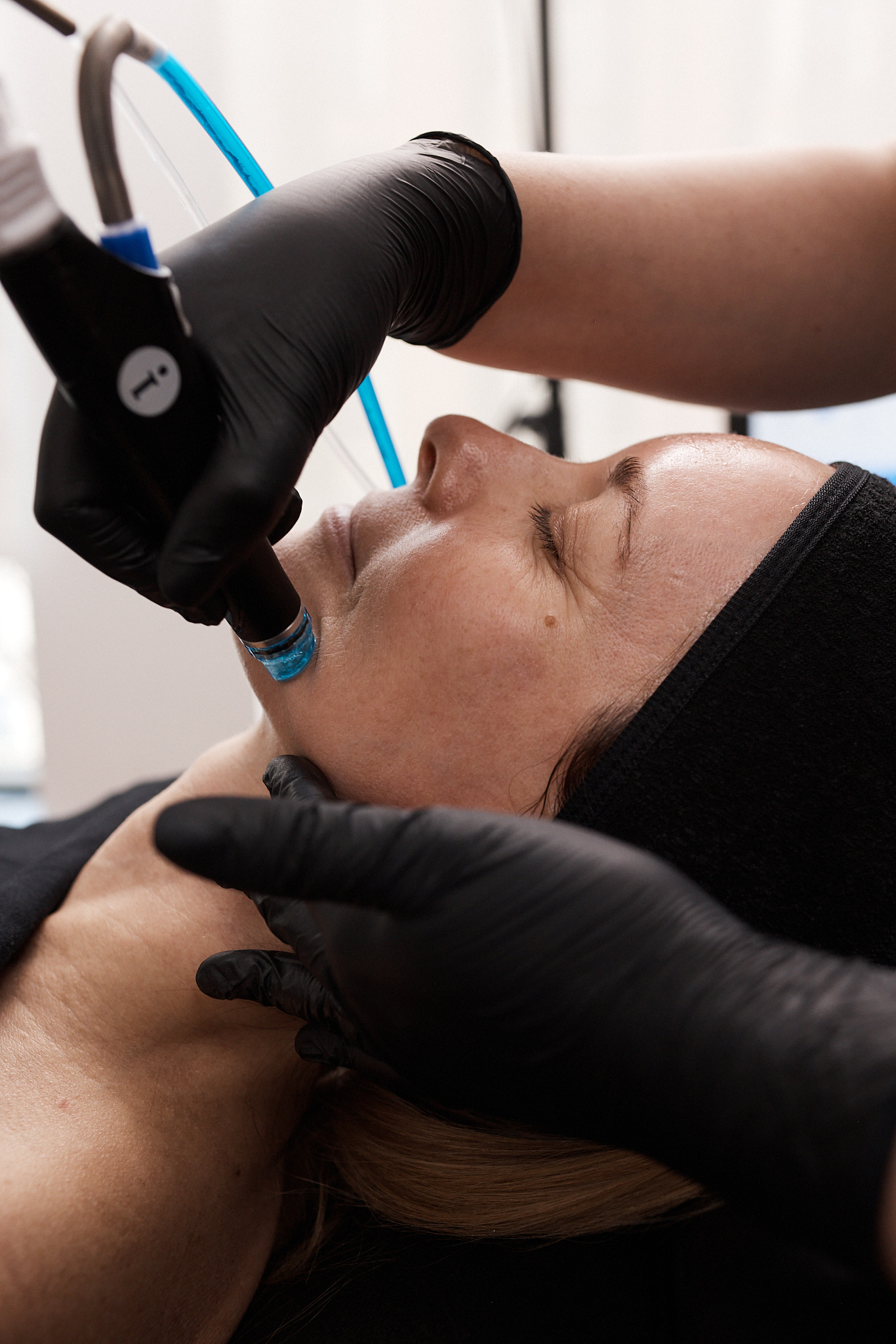 Hydrafacial