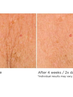 Deco-Lift Neck & Decollete Firming & Lifting Complex