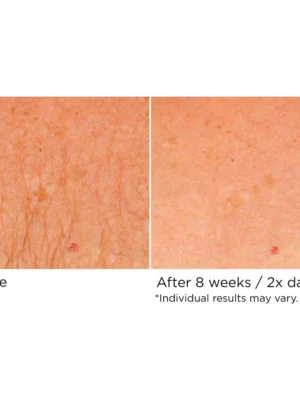 Deco-Lift Neck & Decollete Firming & Lifting Complex