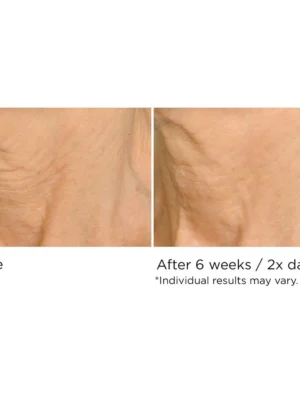 Deco-Lift Neck & Decollete Firming & Lifting Complex