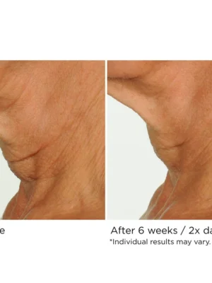 Deco-Lift Neck & Decollete Firming & Lifting Complex