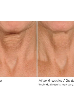 Deco-Lift Neck & Decollete Firming & Lifting Complex