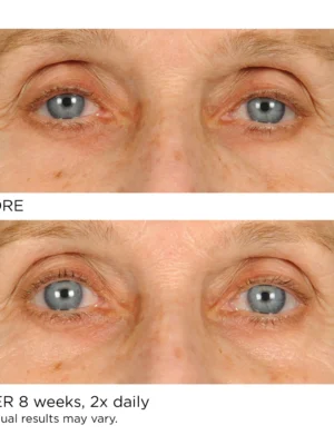 Under Eye Anti-Aging Smoother