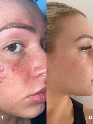 Clinisoothe+ Pročišćivač kože