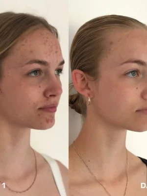 Clinisoothe+ Pročišćivač kože